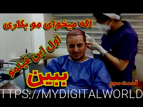 کاشت مو